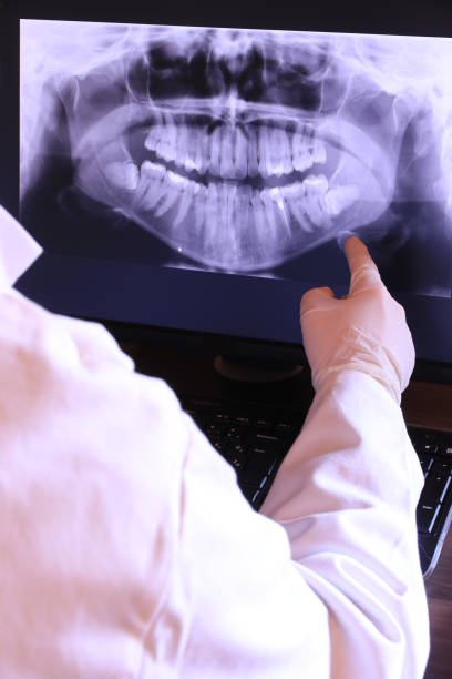 Best Emergency Treatment for Toothache in Saginaw, MI