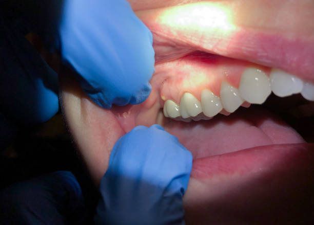 Best Emergency Dental Surgery in Saginaw, MI